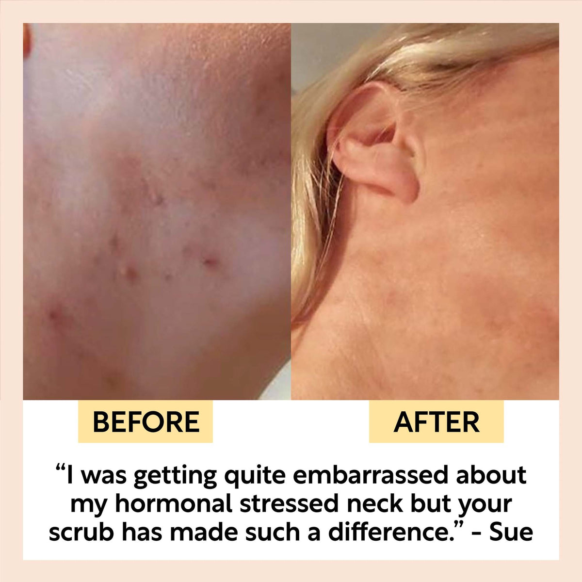 UpCircle Face Scrub with Coffee + Rosehip Oil - Citrus Blend 30g