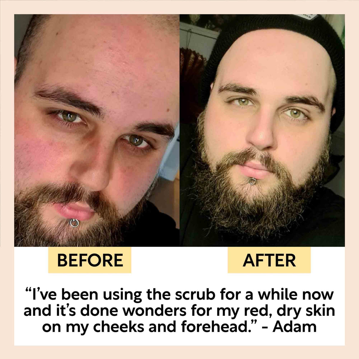 UpCircle Face Scrub with Coffee + Rosehip Oil - Citrus Blend 30g